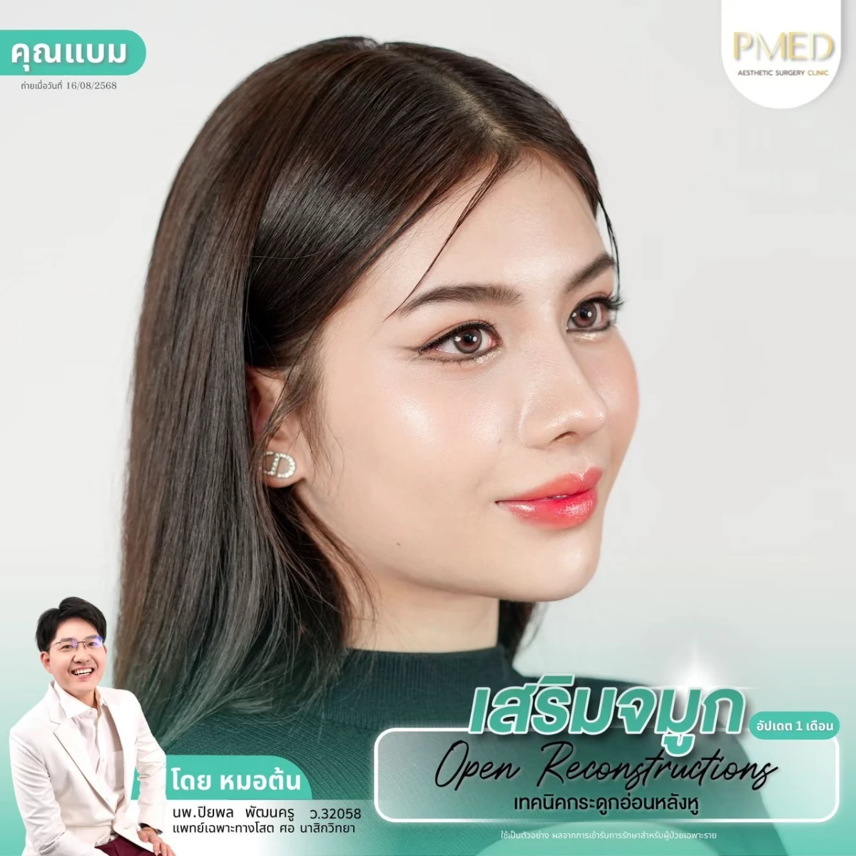 LINE_ALBUM_จมูก 👂🏻 เทคนิคกระดูกอ่อนหลังหู_260715_46