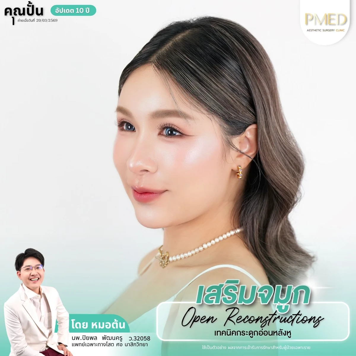 LINE_ALBUM_จมูก 👂🏻 เทคนิคกระดูกอ่อนหลังหู_260715_6