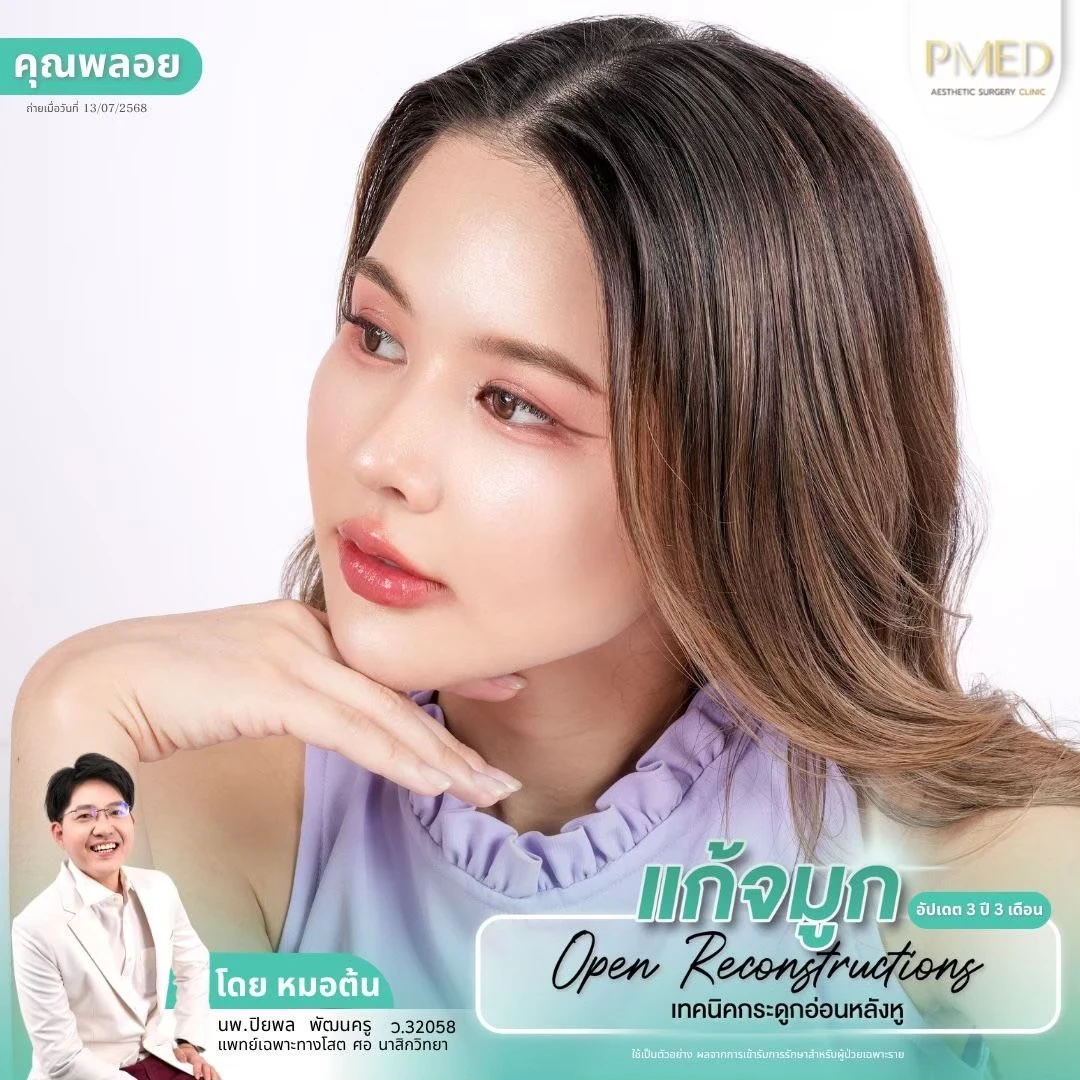 LINE_ALBUM_จมูก 👂🏻 เทคนิคกระดูกอ่อนหลังหู_260715_71