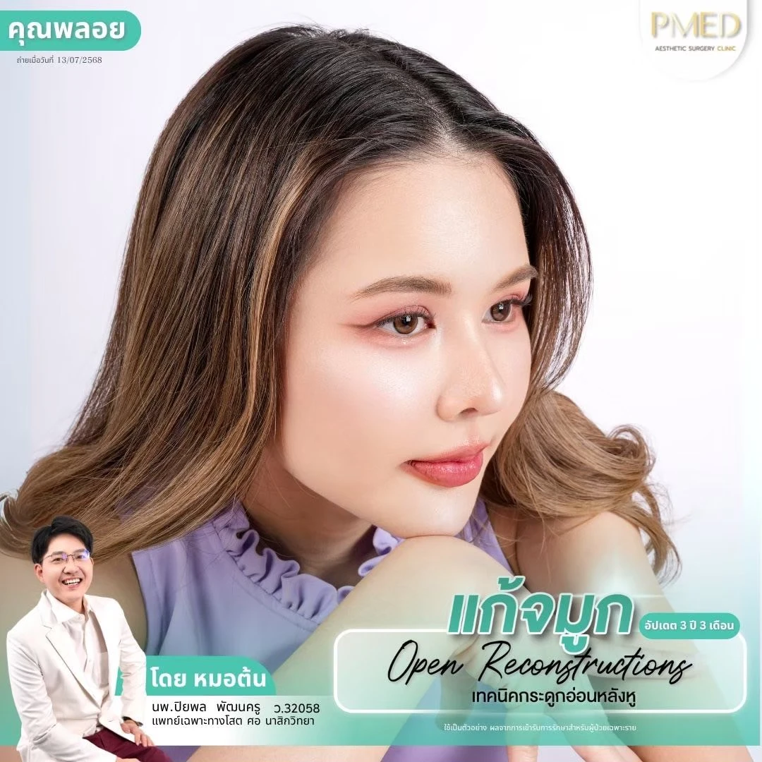 LINE_ALBUM_จมูก 👂🏻 เทคนิคกระดูกอ่อนหลังหู_260715_72