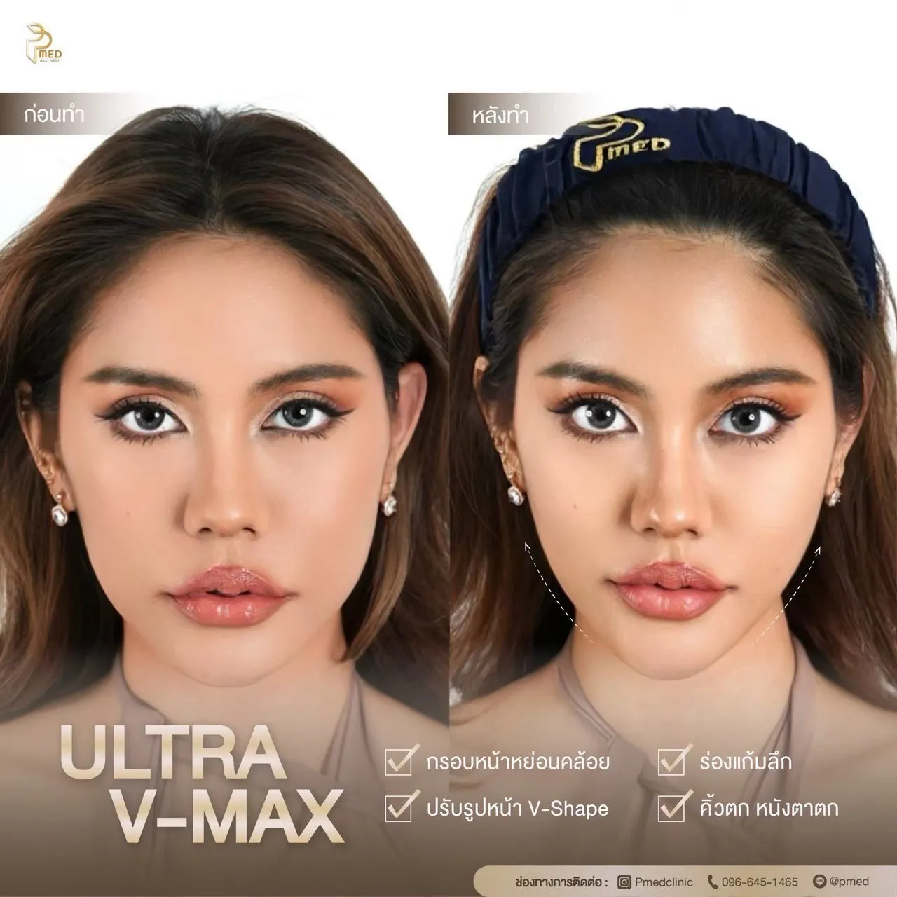 ReviewUltraVmax.2