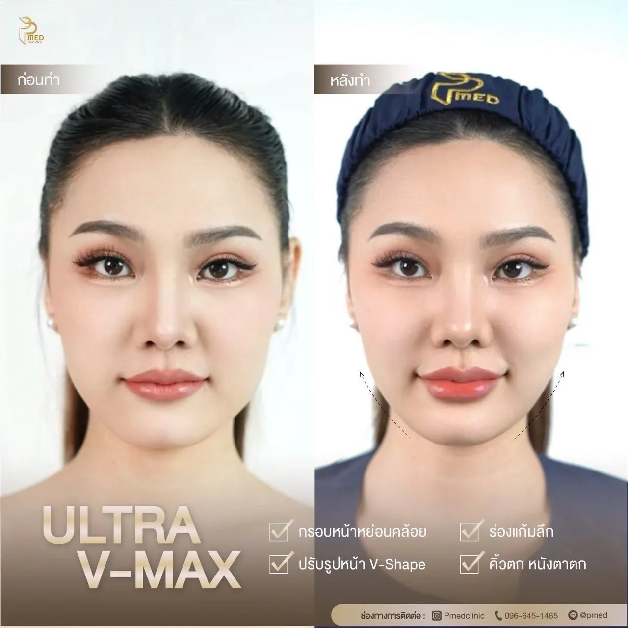 ReviewUltraVmax.26