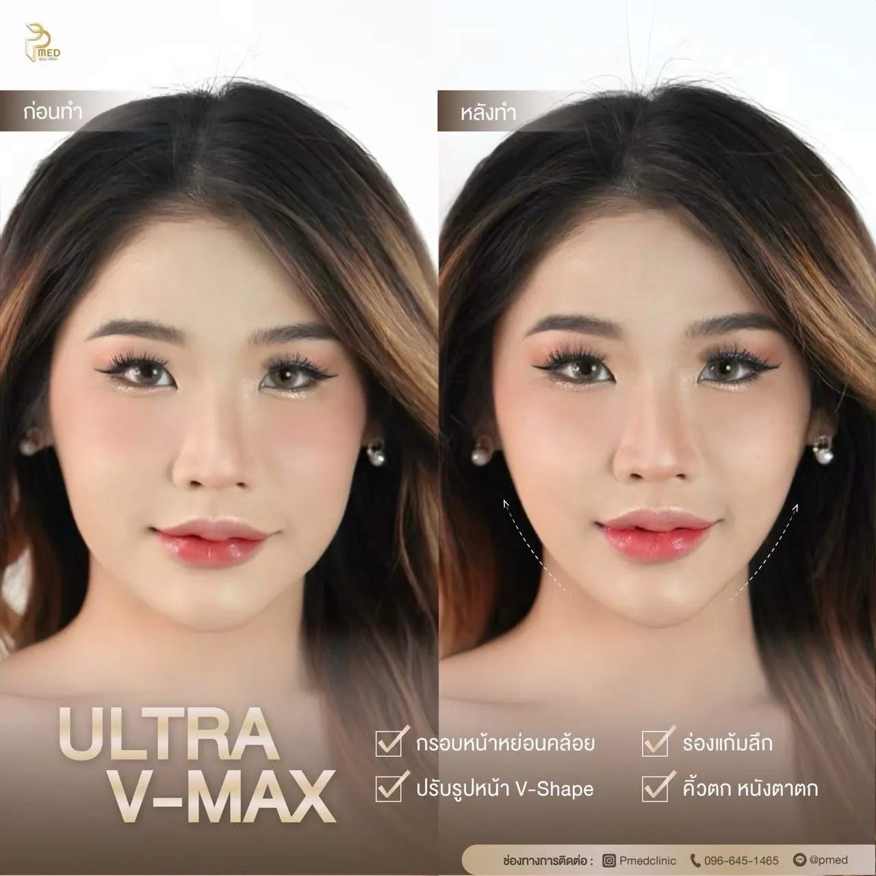 ReviewUltraVmax.3
