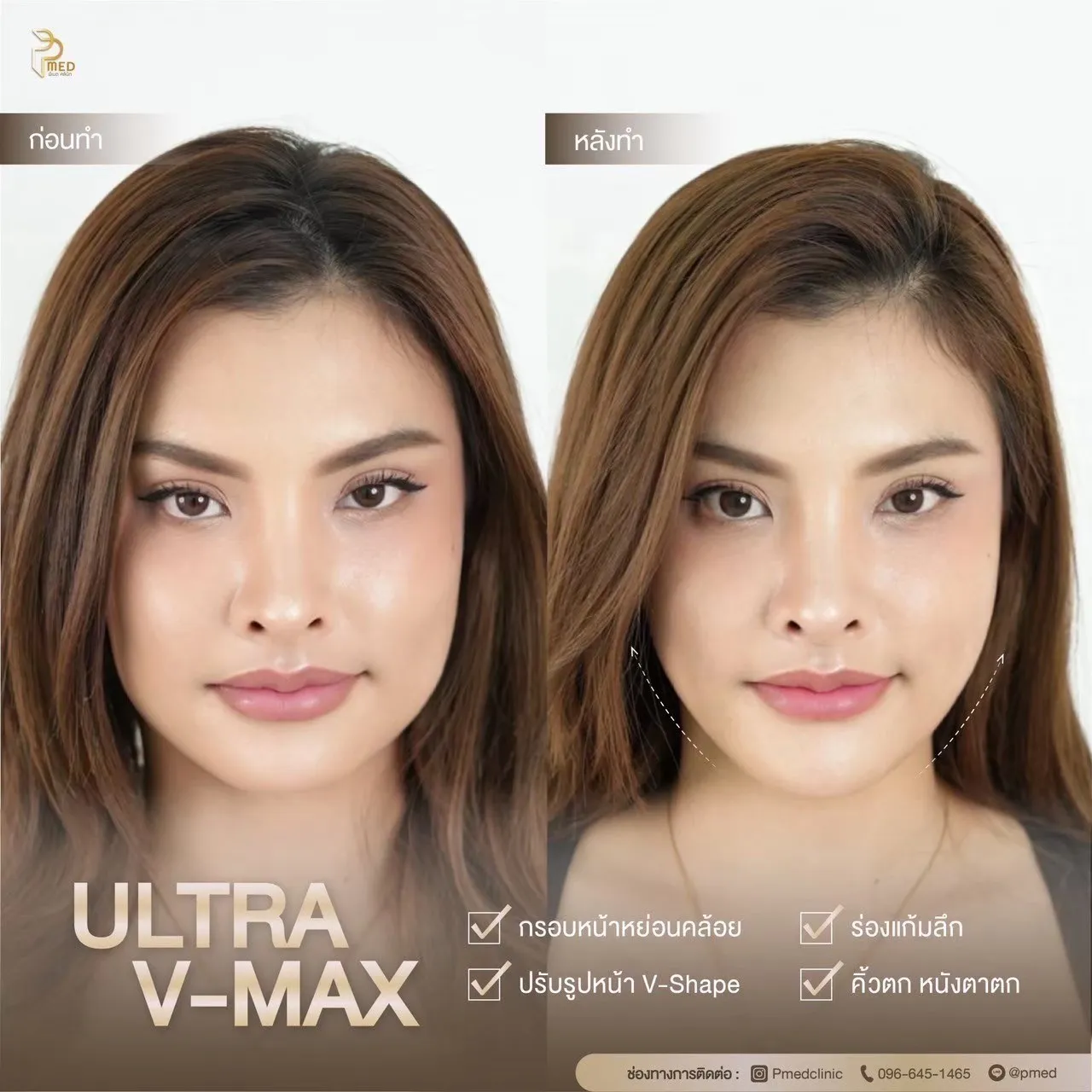 ReviewUltraVmax.4