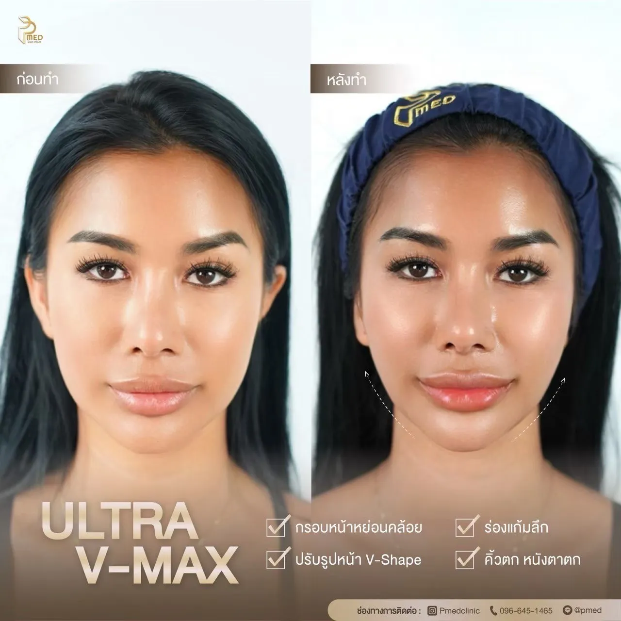 ReviewUltraVmax.5