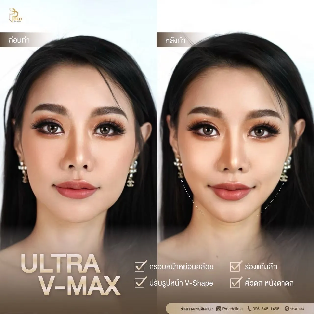 ReviewUltraVmax.7