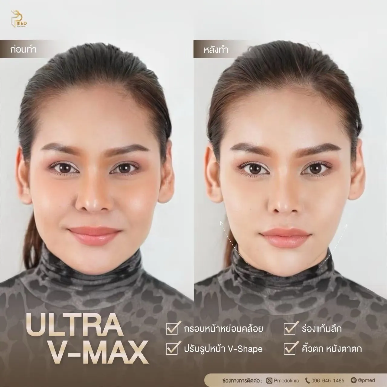 ReviewUltraVmax.8