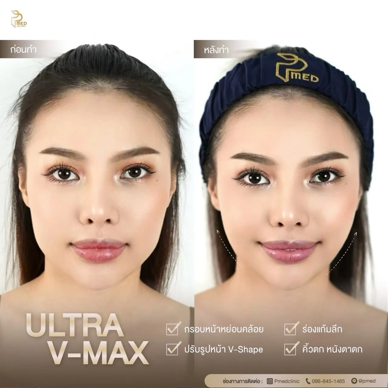 ReviewUltraVmax.9