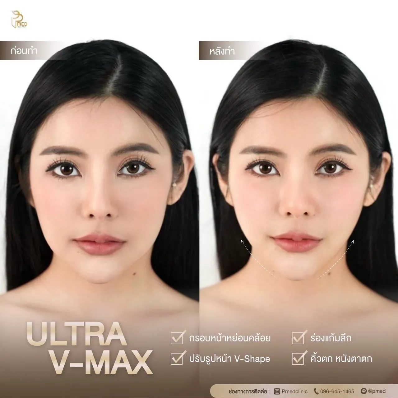 ReviewUltraVmax